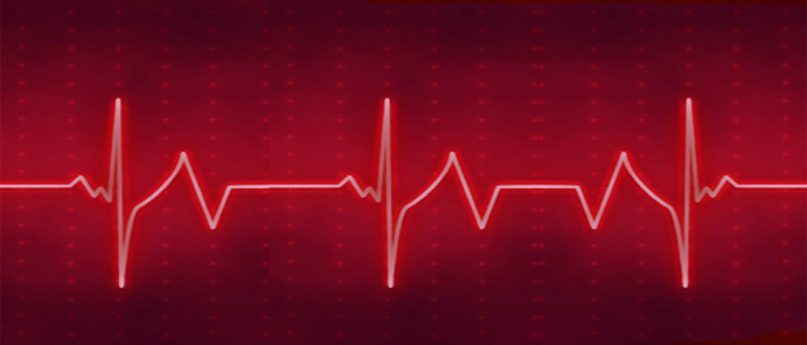 Pulse Detection Circuit